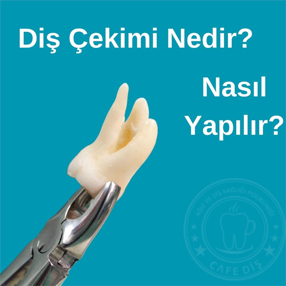 Diş Çekimi